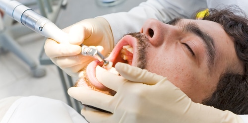 Dental Crowns in Union City, NJ Diana Rodriguez, DMD - Dental Crown Procedure