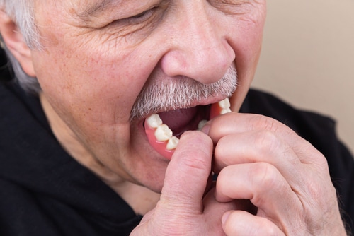 Alternativas a la dentadura postiza | Union City Implant Dentist Explains