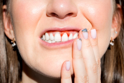 Enfermedad periodontal - El dentista explica los síntomas y los tratamientos