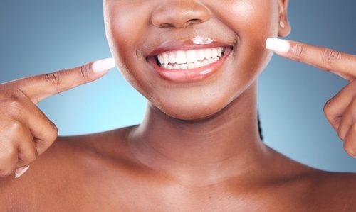 El blanqueamiento dental de venta libre es menos eficaz | Union City | Dr. Rodriguez