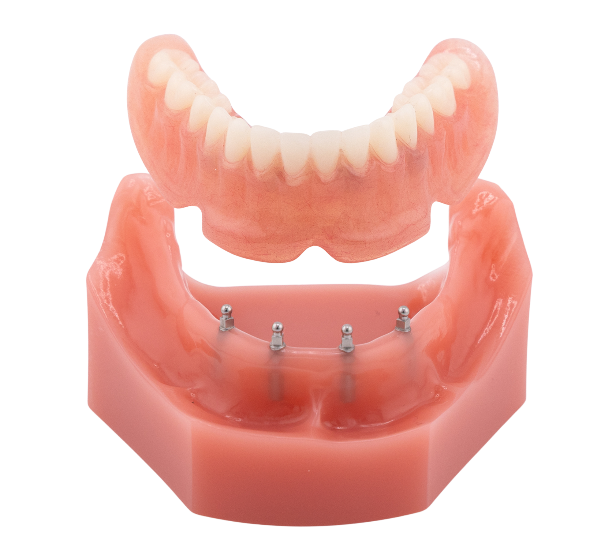 Snap-In Dentures in Union City, NJ | How Mini Dental Implants Stabilize Loose Dentures | Understanding Denture Alternatives | Diana Rodriguez & Associates