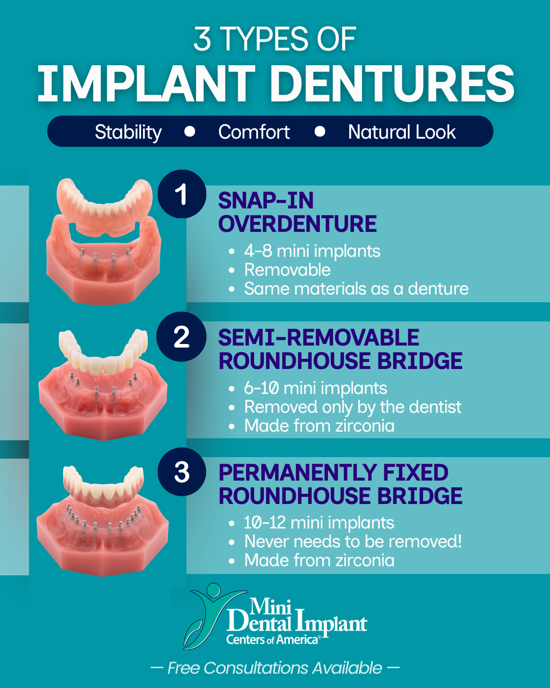 Full Mouth Dental Implant Treatment | Implant Denture Options | Free Consultations in Union City, NJ