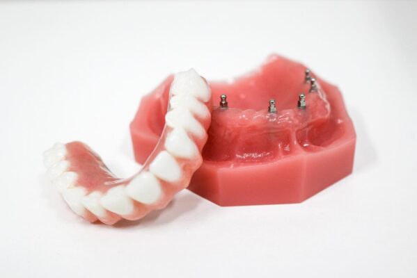 Mini Dental Implant Dentures in Union City, NJ | Free Consultations