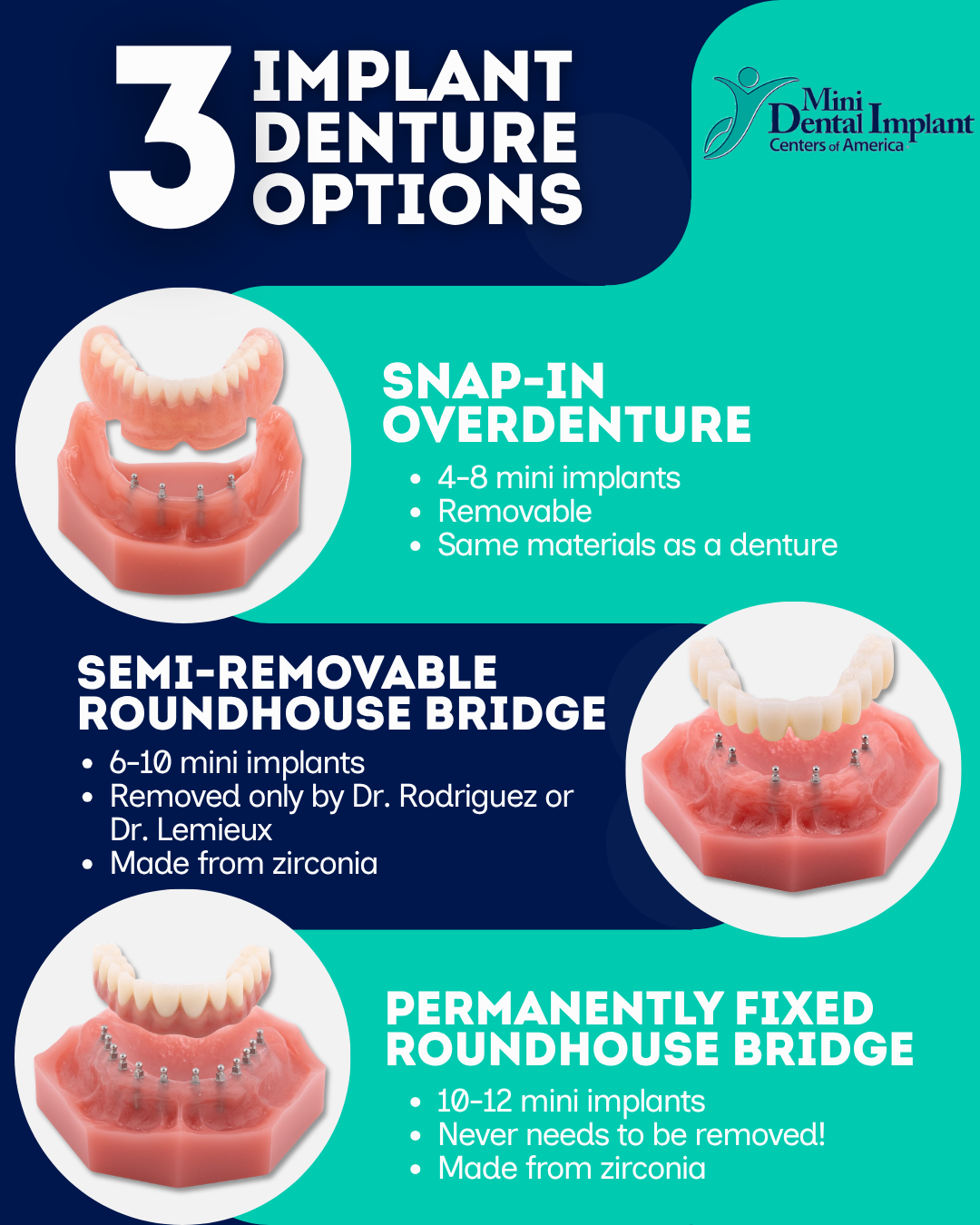 Mini Dentaduras de Implantes Dentales en Union City, NJ | Consultas Gratuitas